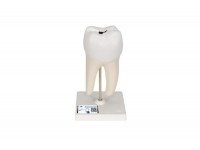 model 6-częściowego zęba trzonowego z ubytakmi, powiększony 15 razy - 1013215 [d15] 3b scientific modele anatomiczne 12